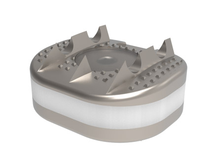 Spinal implant D-Flex Titanium Cervical Disc Prosthesis