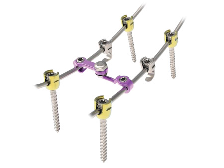 Spinal implant Pedifix Posterior Thoracolumbar Fixation System