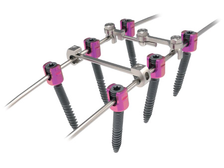 Spinal implant Quatro Quad Lead Thoracolumbar Screws