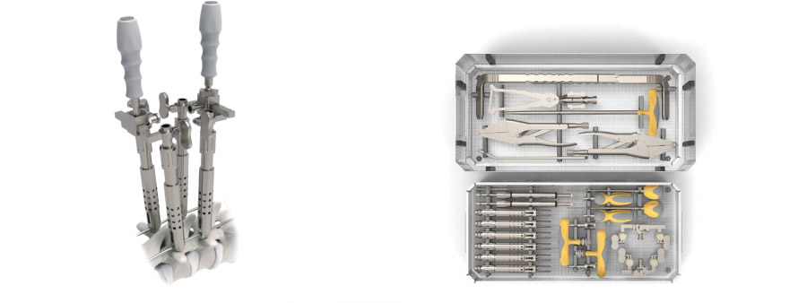 Spinal implant Towerfix Scoliosis Deformity Instrument Set