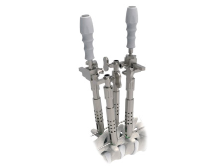 Spinal implant Towerfix Scoliosis Deformity Instrument Set