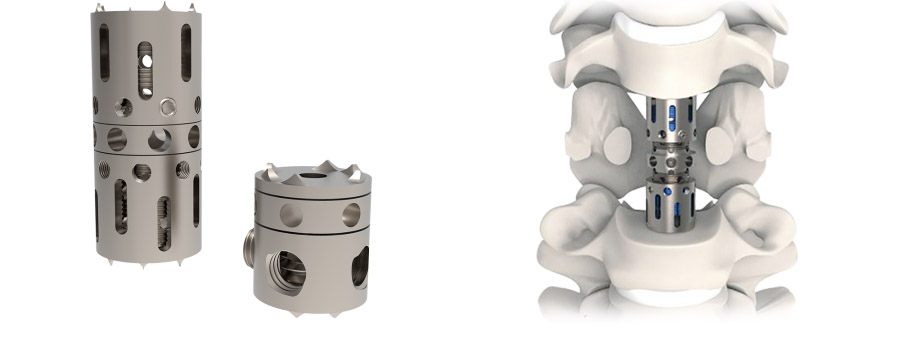 Spinal implant Vertelift-C Anterior Cervical Corpectomy Cage