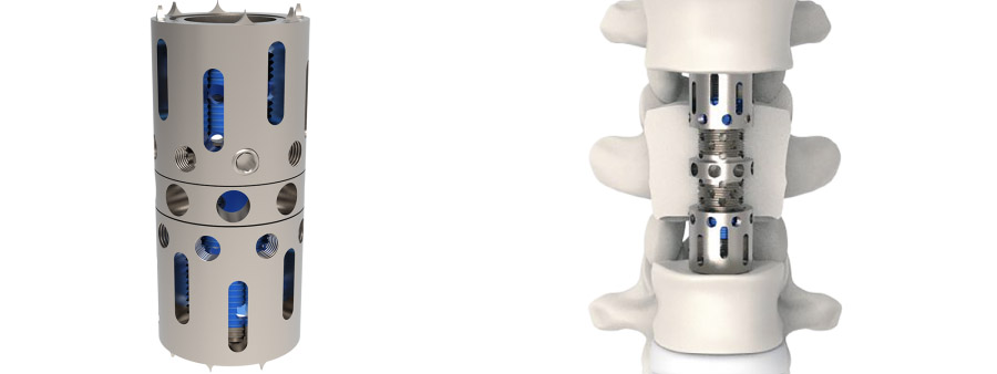 Spinal implant Vertelift-T Anterior Thoracolumbar Corpectomy Cage