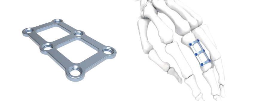 Trauma Plate H Hand&Foot Plate Long