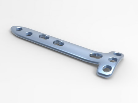 Trauma Plate High Tibial Osteotomy Locking Plate