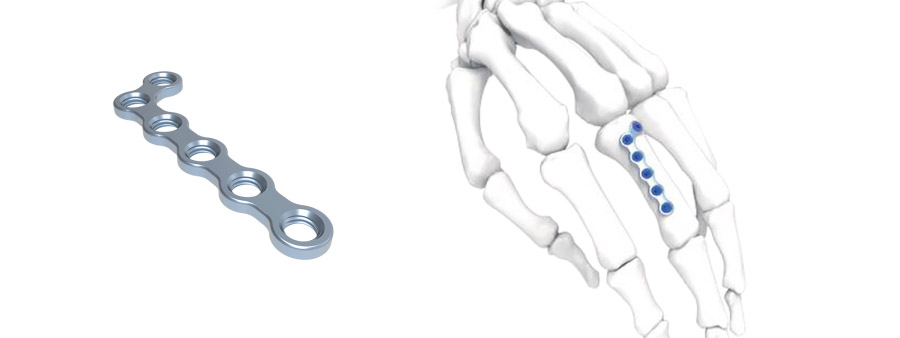 Trauma Plate L Oblique Right Hand&Foot Plate