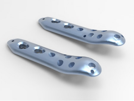 Trauma Plate Proximal Femoral Locking Plate